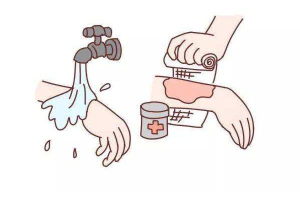 男子照顧大面積燒傷女友6年 大面積燒傷要多長時間才會恢復