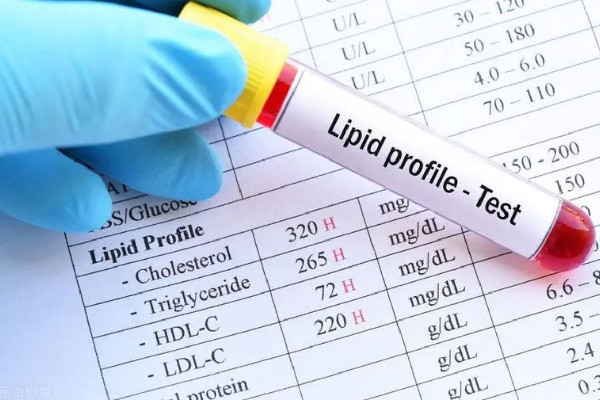 血脂檢測為何有必要從娃娃抓起 血脂檢測包括哪些項(xiàng)目